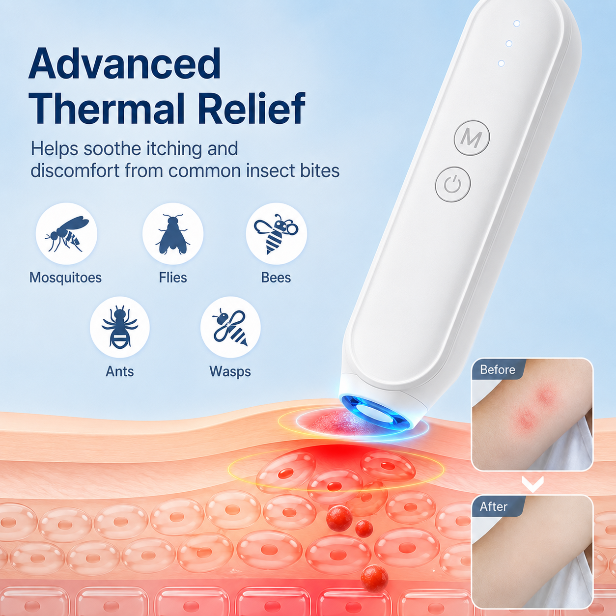 Themriva Bite Healer