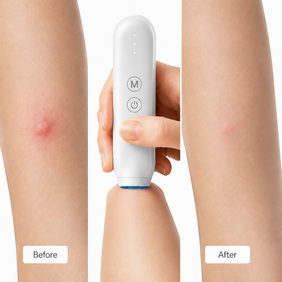Themriva Bite Healer